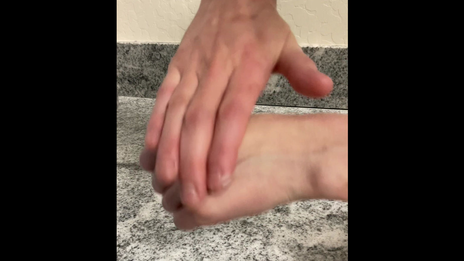 Calcipotriene Fluorouracil Topical